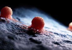 3d rendered medically accurate illustration of a cancer cell